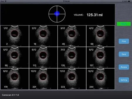 Hochey machine médicale portable Mini-ordinateur de poche sans fil 4D de la vessie du scanner à ultrasons