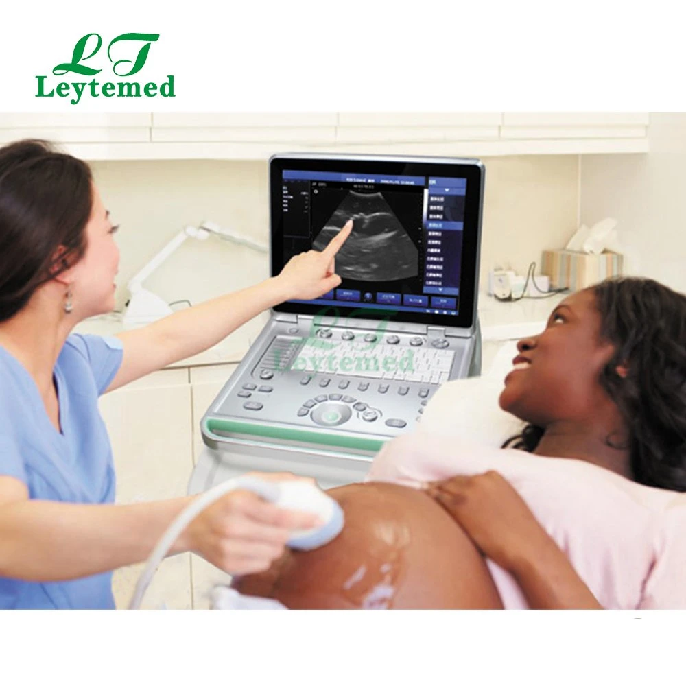 Ltub19 Cheap Portable 15 Inch Laptop Ultrasound Scanner Medical Used for Human