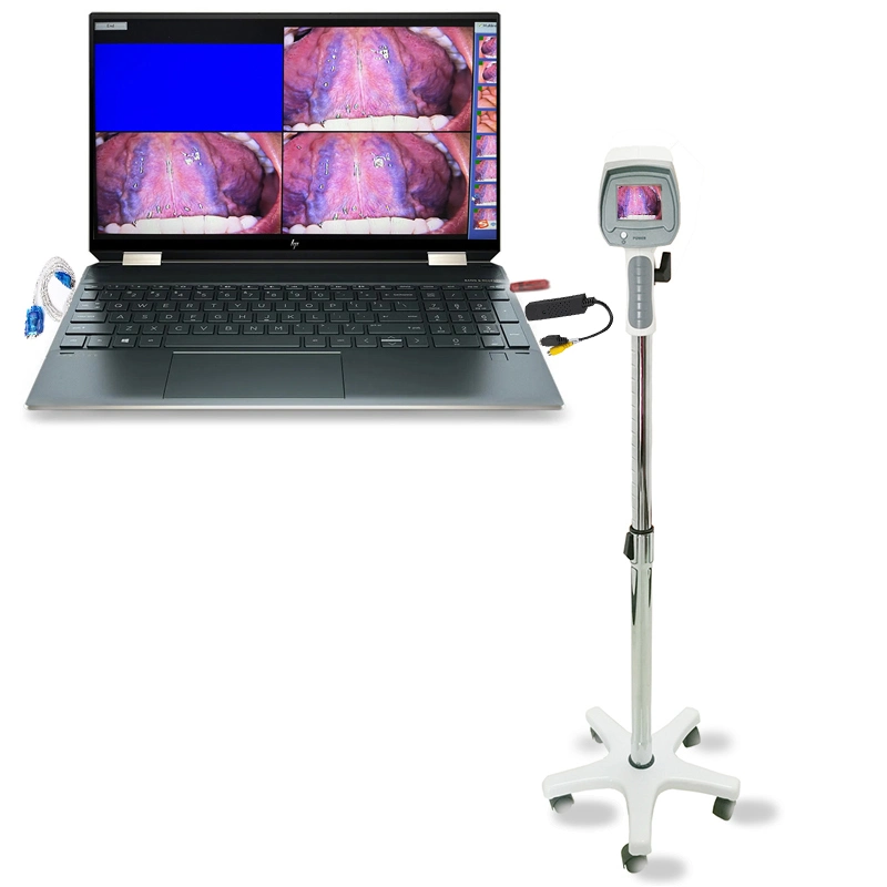 Colposcopia máquina de video digital Colposcopio para Ginecología