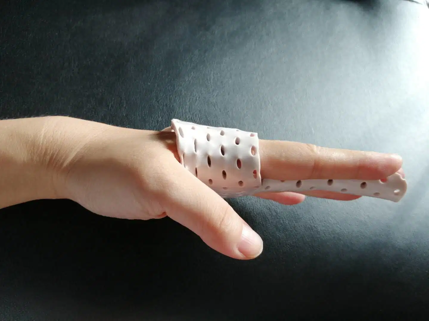 Thermoplastic Fracture Finger Splint Deformity Finger Correction