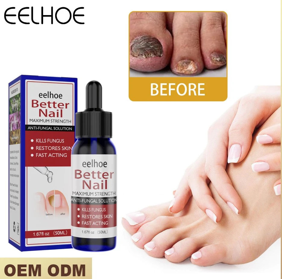 Fungal Nail Repair Essence Serum 50 мл Care Treatment Foot Nail Гель для удаления грибов Антиинфекция Уход за ногтями