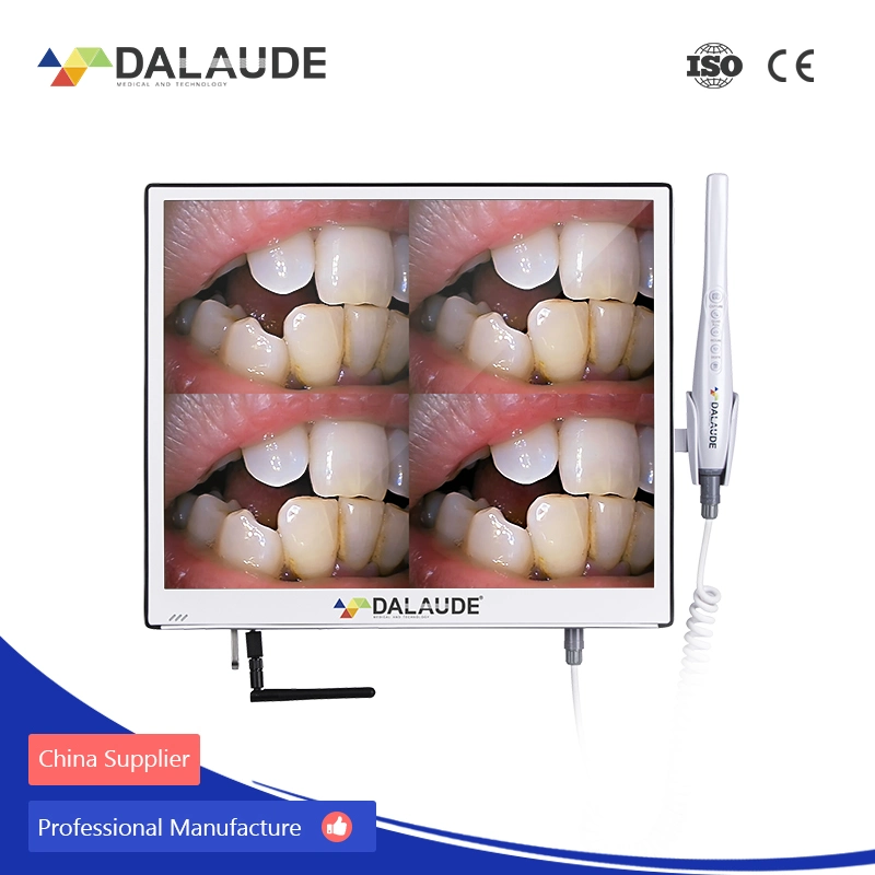 Metallgehäuse Ultrain Monitor mit HD Intraorale Kamera, Dental Equipment