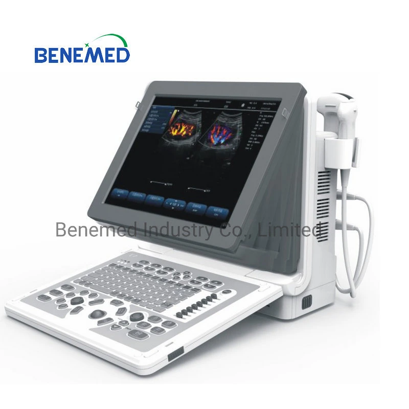 2D Echo Color Doppler Ultrasound Scanner Hospital Equipment