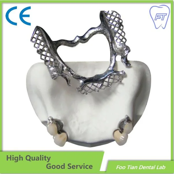 La venta acerca de CAD/CAM Vitallium fundido de metal Dentaduras Parciales desde China Laboratorio dental