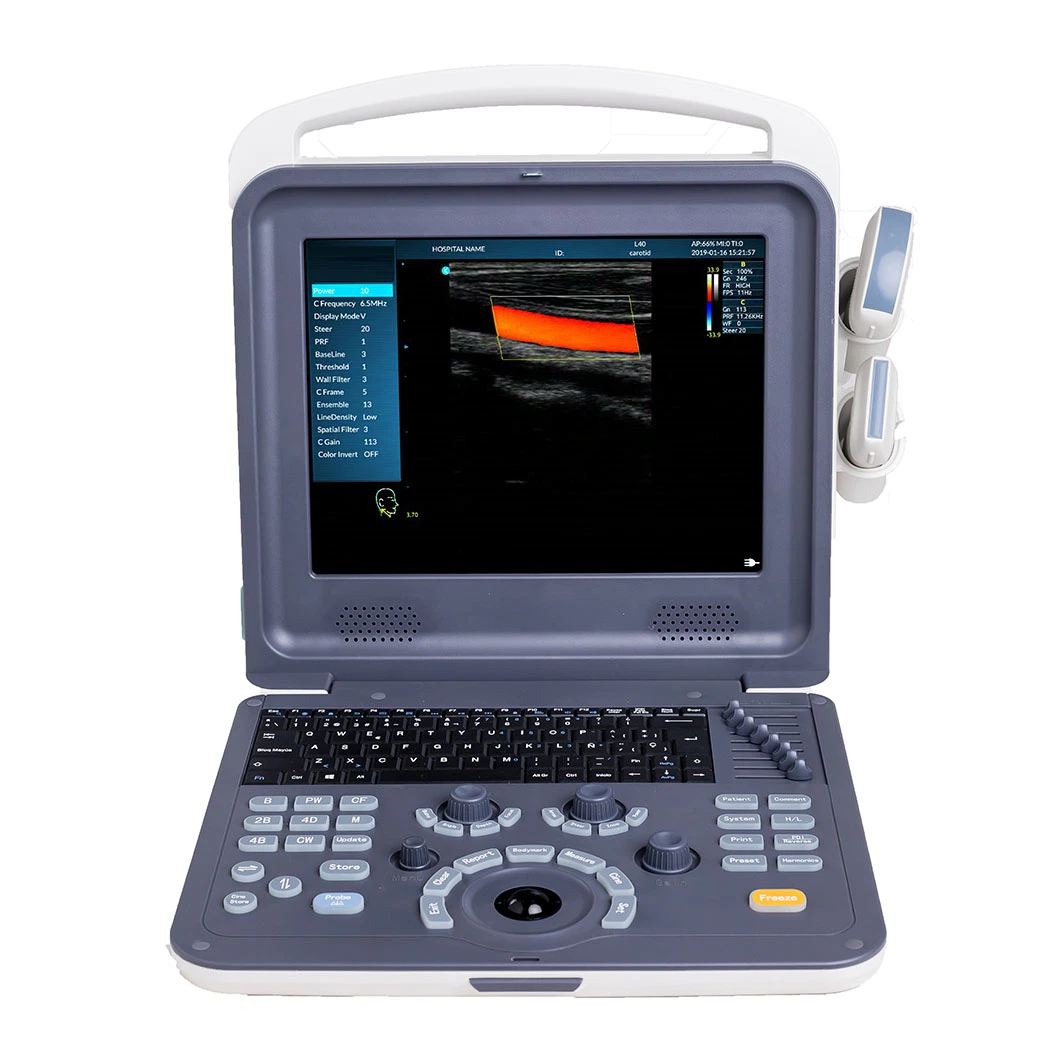 Hand-Carried máquina de ultra-sonografia dopler colorido portátil Scanner de diagnóstico