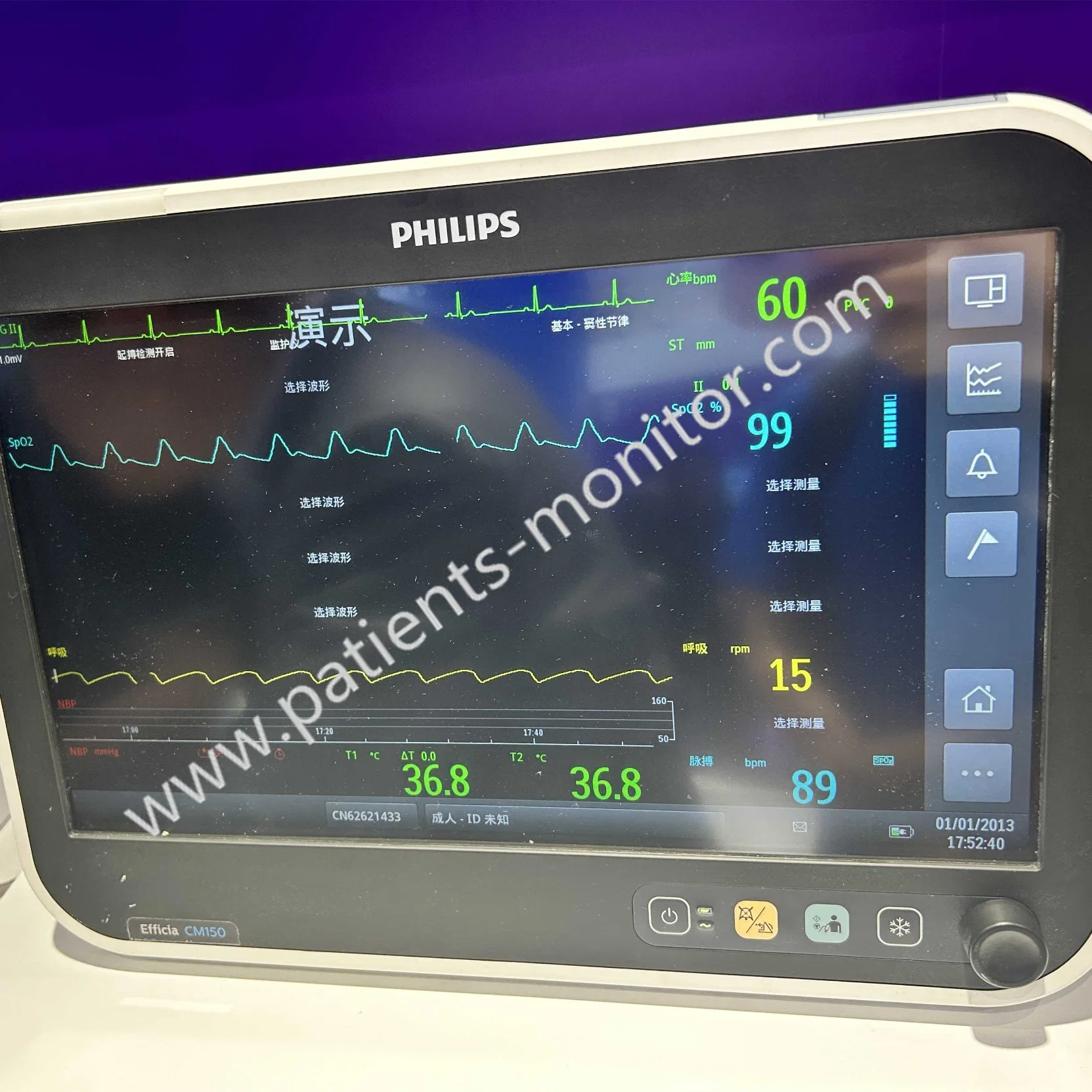 Philips Efficia Cm150 Patientenmonitor Gebrauchtgeräte mit gutem Zustand Zum Verkauf