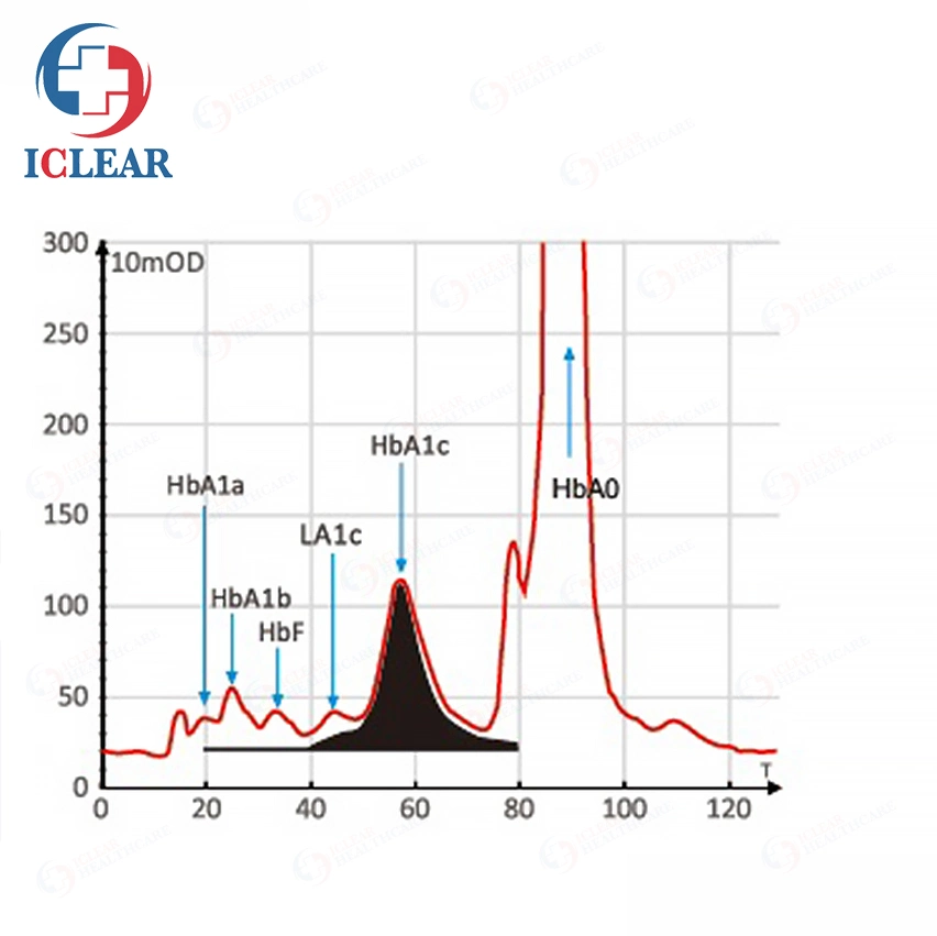Lab Hemoglobin Analyzer High-Performance Liquid Chromatography HPLC Hbac1 Analyzer