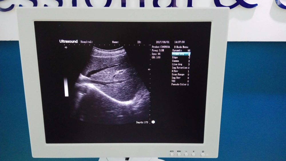 Hospital Equipment B/W Trolley Ultrasound Scanning Machine for Human (THR-US370)