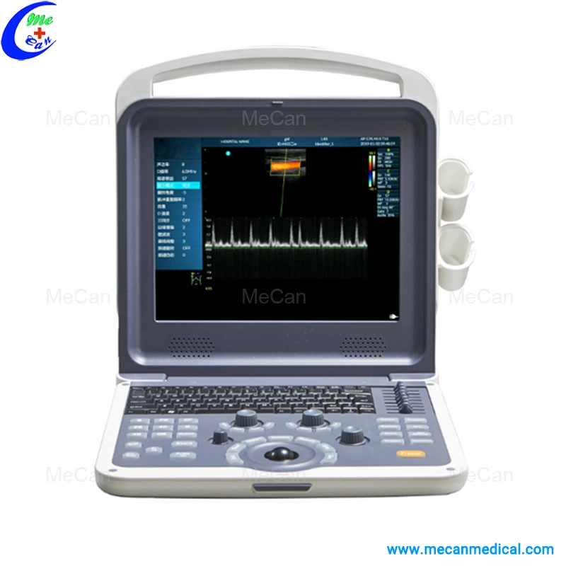 Full Digital Color Doppler Ultrasound Diagnostic System Portable Ultrasound