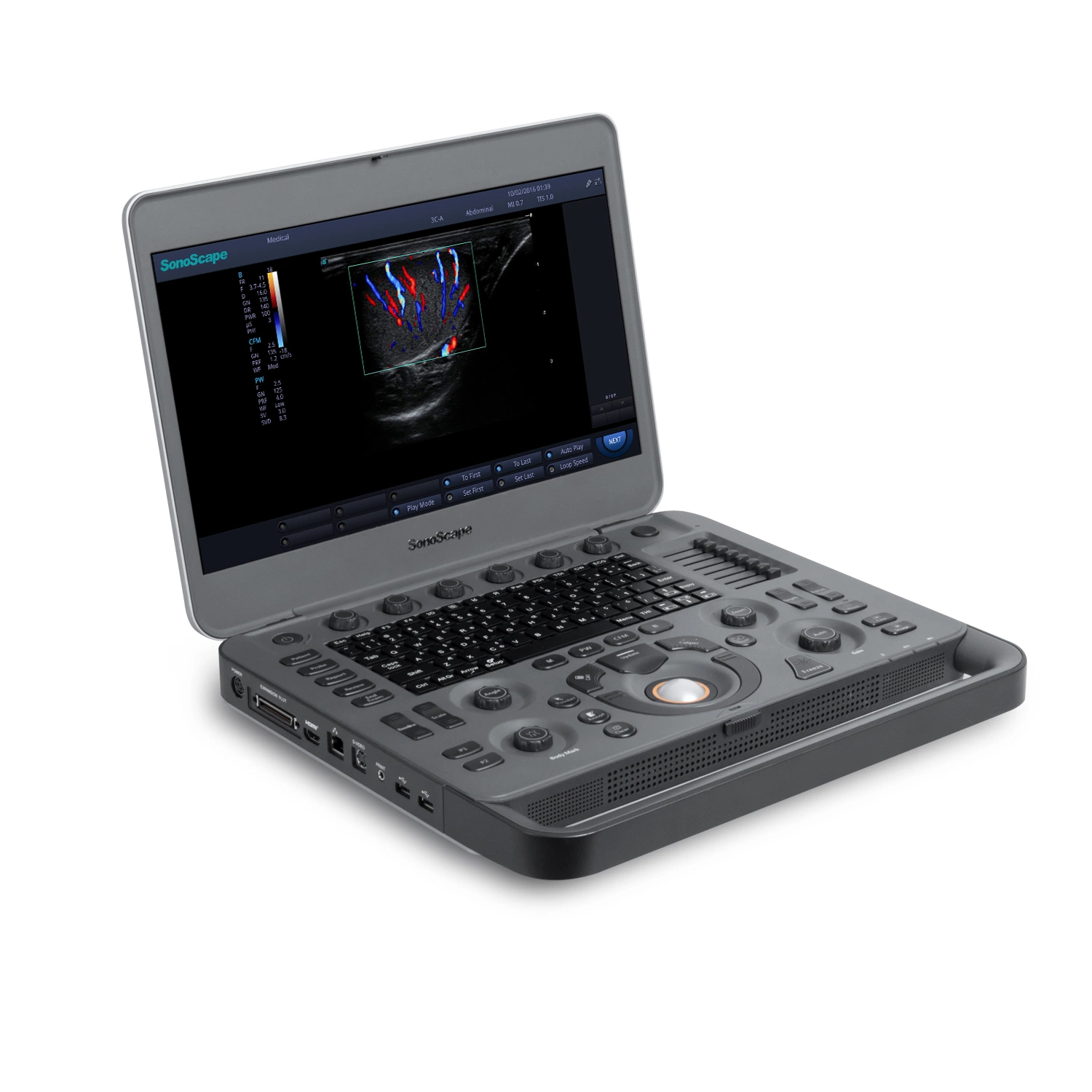 Sonoscape Latest Laptop Color Doppler Ultrasound System