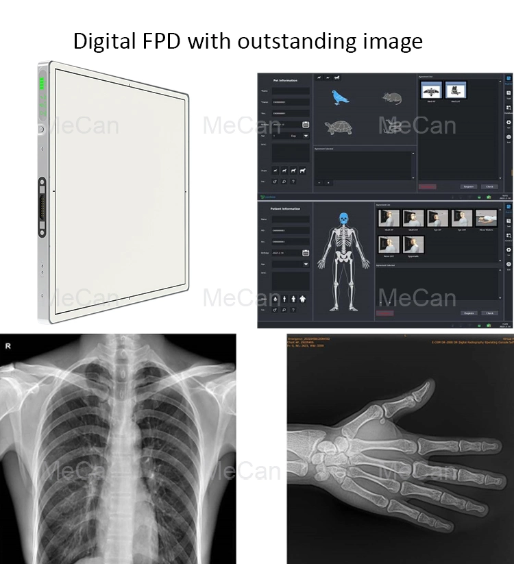 Máquina de rayos X digital del hospital con embalaje de madera