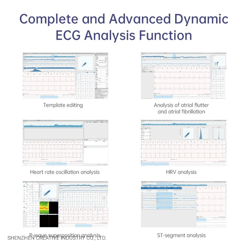 Lepu Medical Equipment ECG for Heart Electrocardiogram 3 Leads Wtih Cadioscan 12. Software