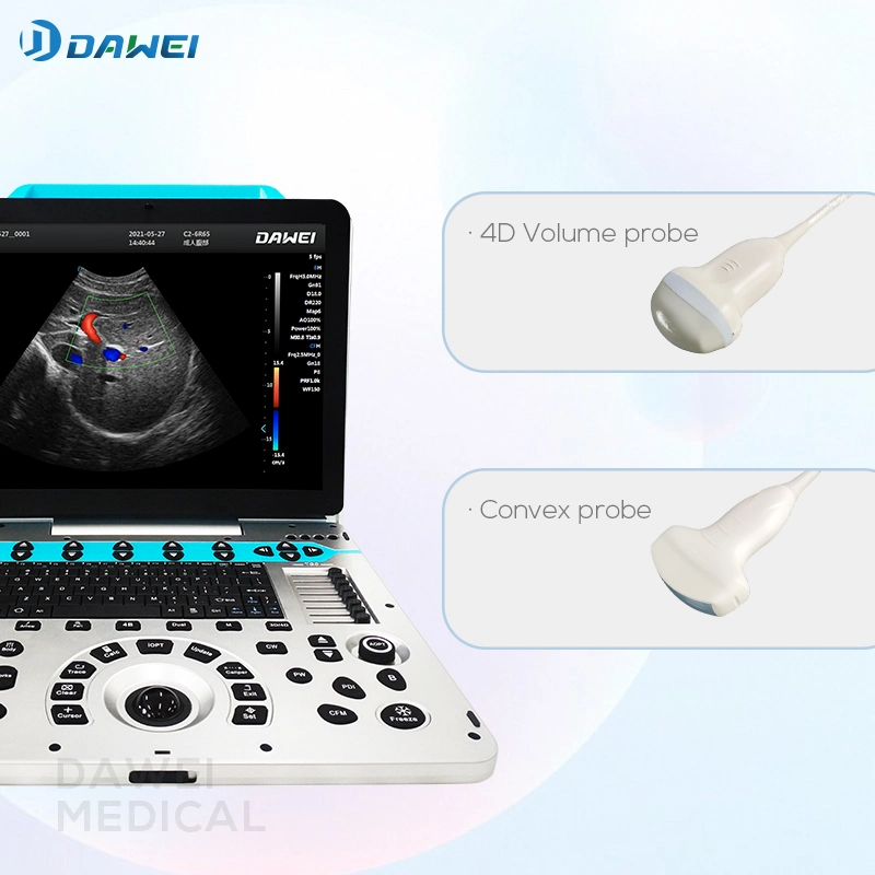 Hot Sales Ultrasound Scanner Equipment for Clinic with CE&ISO