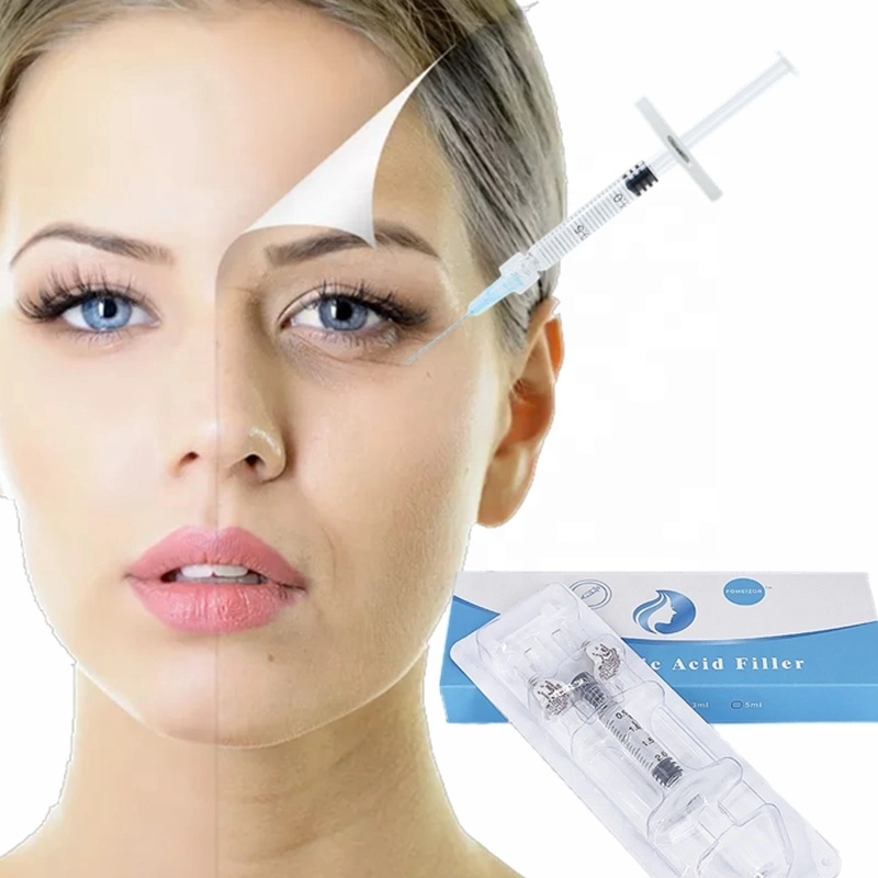 Injectable 2ml Dermal Filler Anti-Wrinkle Injection Hyaluronic Acid Face Filler