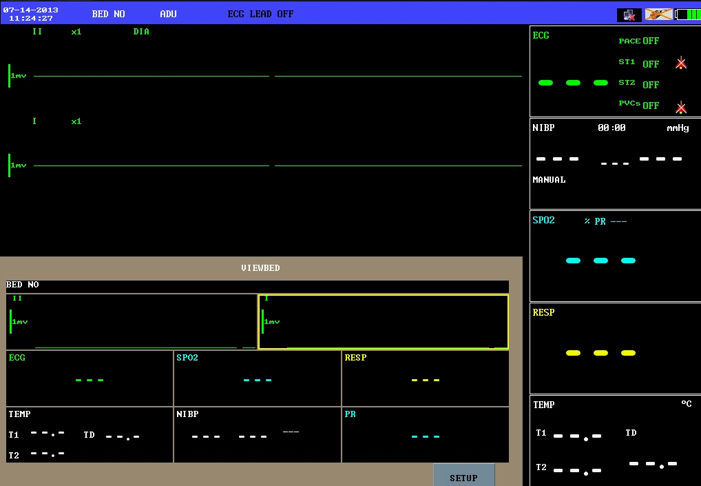 H500-30 Hôpital Multi-Parameter ICU Moniteur patient