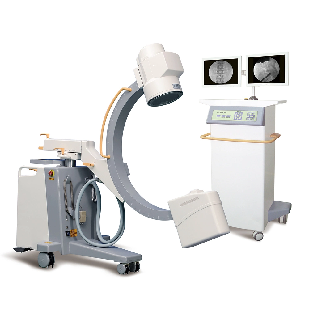 El equipo de radiología del hospital de fluoroscopia de rayos X médicos del dispositivo de la máquina de rayos x brazo C Departamento Quirúrgico