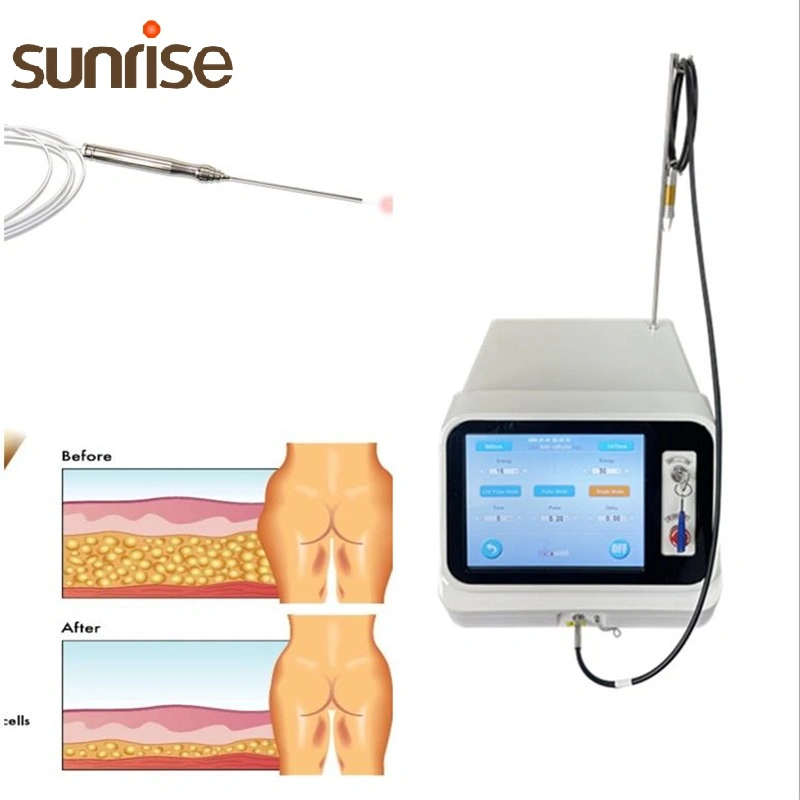 Máquina quirúrgica médica 1470nm 980nm Liposis tratamiento de disco lumbar Ent Dispositivo láser de terapia física