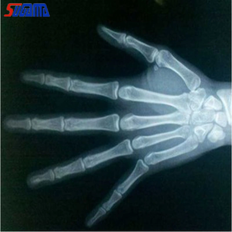 نظام X Ray Film الطبي ذو اللون الأزرق الحساس للاستخدام الرطب