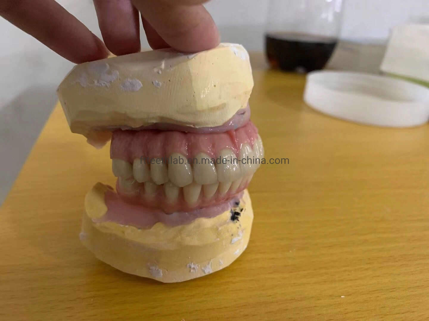 Эстетическим обедненной смеси все 4 стоматологической имплантации мост стоматологической имплантации