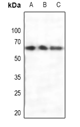 Estrogen Receptor Alpha Polyclonal Antibody