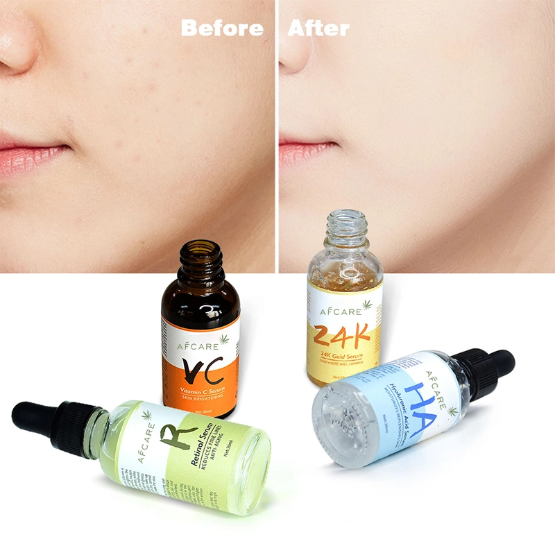 30ml Face Skin Care Acne Whitening Essence Liquid Serum Wrinkle Anti Aging Moisturizing Liquid Organic Oil Face Serum Body Care Face Serum