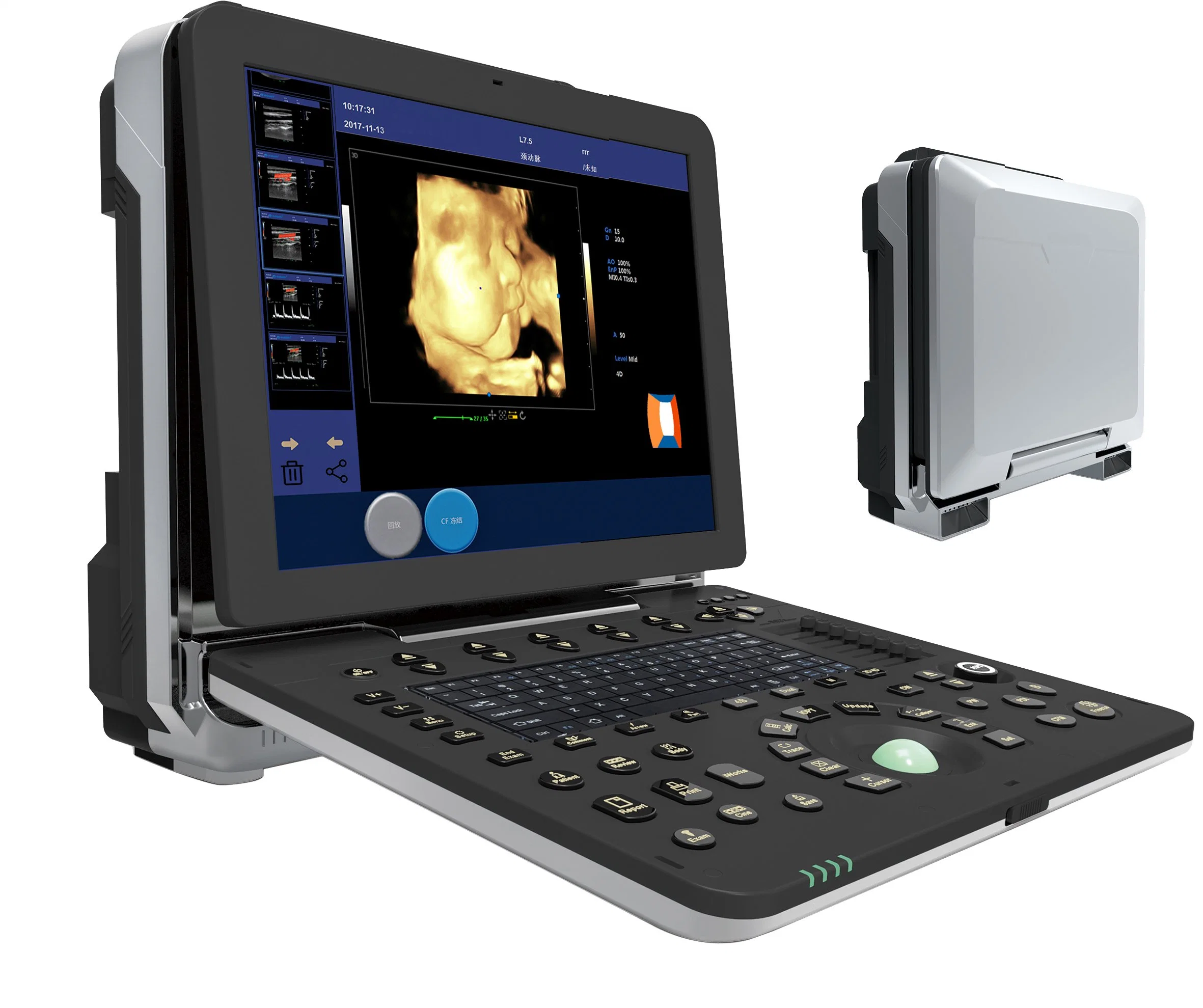Medical Equipment Hopsital Use Portable Color Doppler Ultrasound Diagnostic Machine Ultrasound Scanner