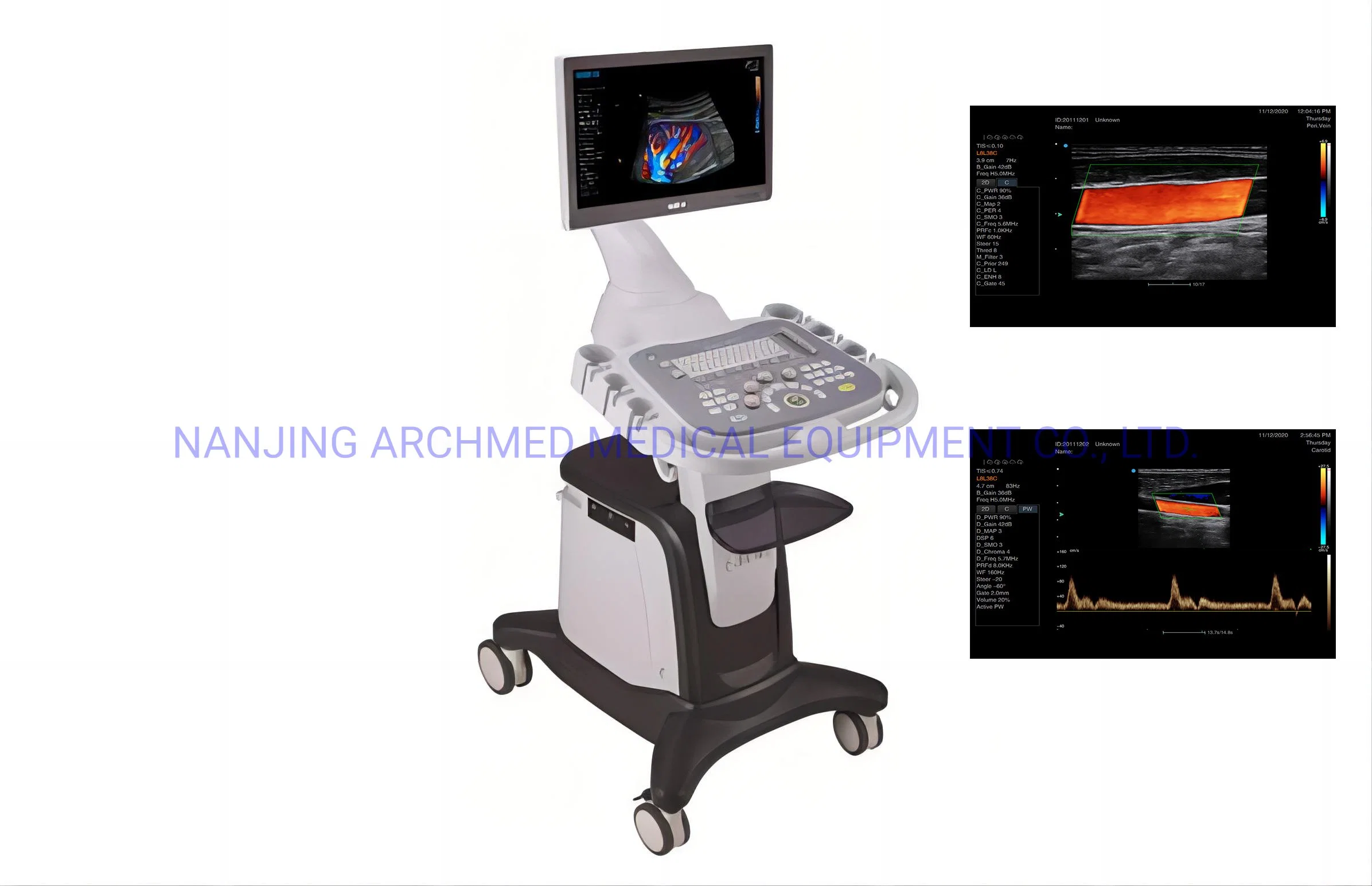 Medizinische Geräte Voll Digital Tragbare Farb-Doppler-Diagnosesystem Ultraschall Scanner-Ultraschallmaschine mit 18,5′ ′ LCD-Monitor