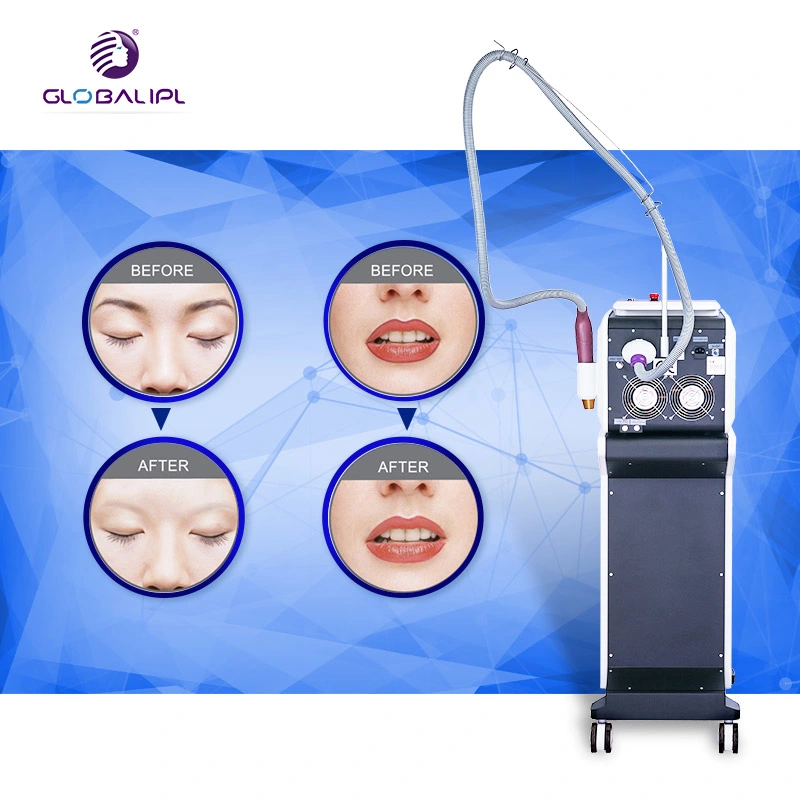 Honeycomb Tip Skin Rejuvenation Tip Visible Effict Tattoo Removal ND YAG Machine