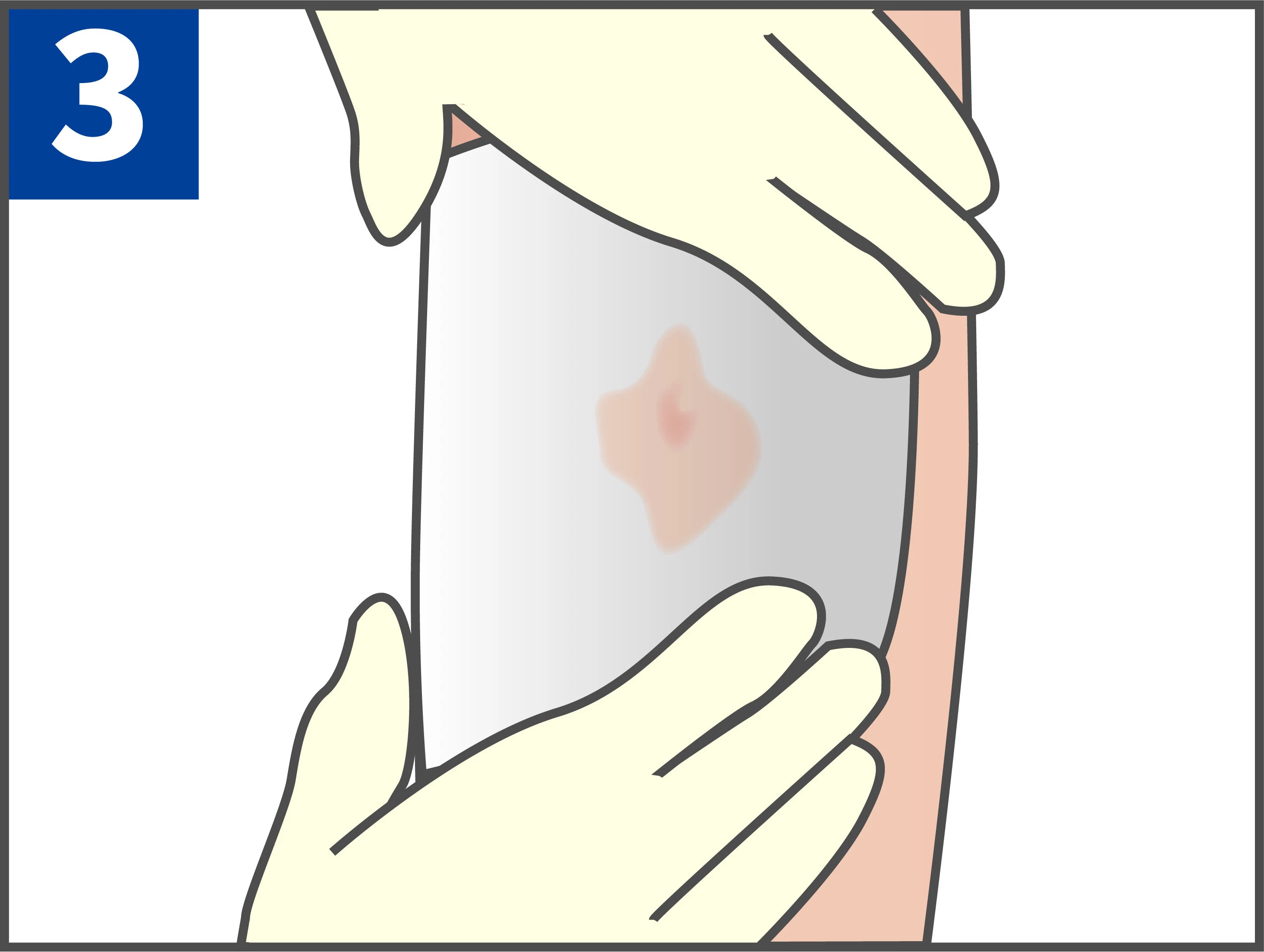 Disposable Medical Sterile Dressing with Low Dressing Change Injury