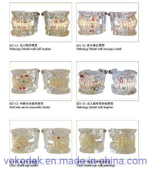 2 Times Sized Educational Dental Standard Teeth Model