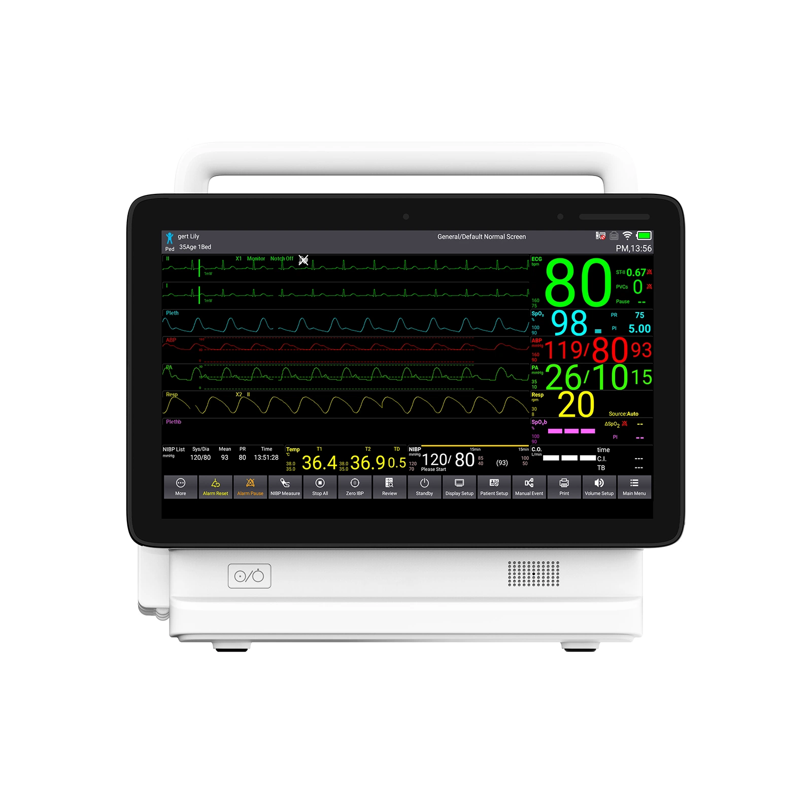 وحدة Contec Ts13 Multi Parameter Modular Patient Monitor-Hospital Medical Equipment