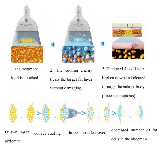 2021 4D Cryo Machine 5 Handles 360 Cooling Slimming Fat Reduction Non-Invasive Low Pain Beauty Equipment Price