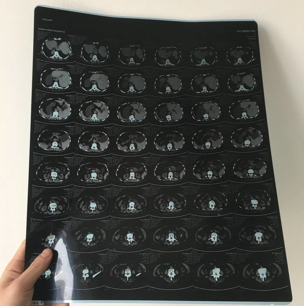 Agfa Drystar 5302 с помощью цифровой медицинской рентгеновской пленки 28*35 см синего цвета изображения