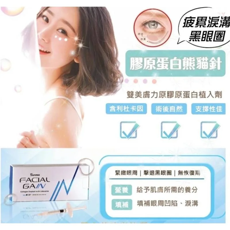 Facial Gain Collagen Pcl Polycaprolactone Polylactic Acid Collagen Agent Pn Face Lifting Profhilo H+L Pcl Joyarona Dmae 7 Therafill Pubertype Essence