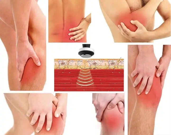 Portable Shockwave Therapy Equipment Pain Removal Eswt Physiotherapy Pain Removal Shockwave