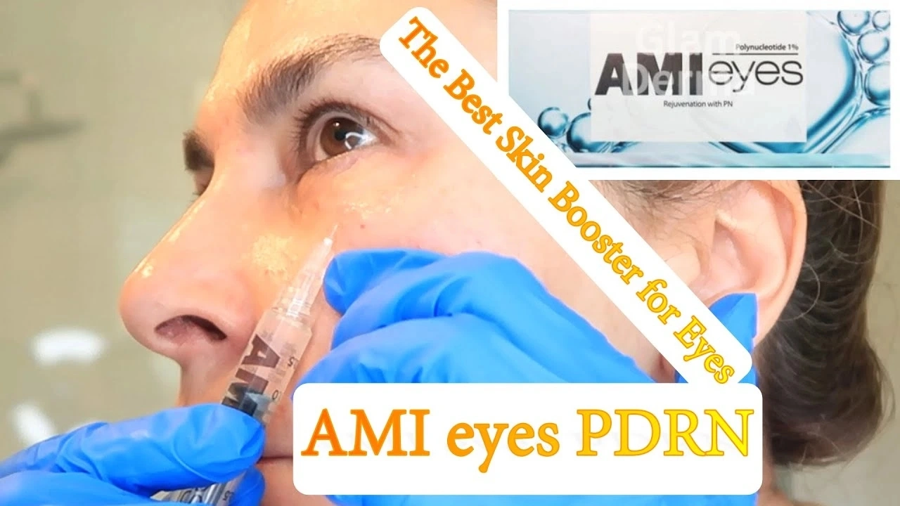 Ami Eyes Pn 1% - 2 Ml Online Sale Cheap Price Dermal Filler Wrinkle Treatment Eye Bag Ami Skin Eye Skin Booster Ami Filler Ami Injection Ami Product