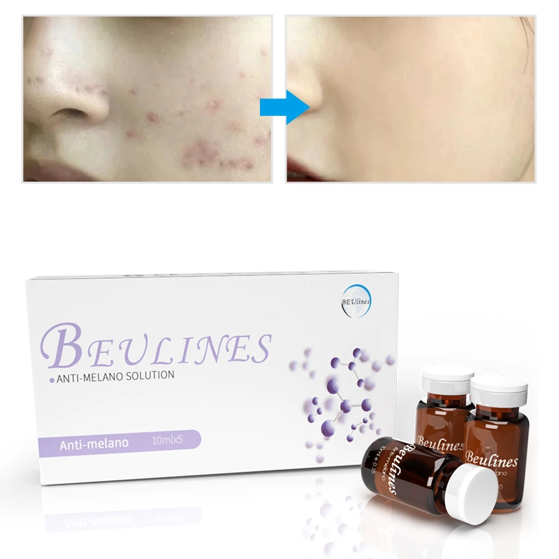 Hiperpigmentação rosto do corpo sob o braço brilhante Remove Dark Acne Spot Tratamento pele clareamento conjunto de produtos de branqueamento da pele