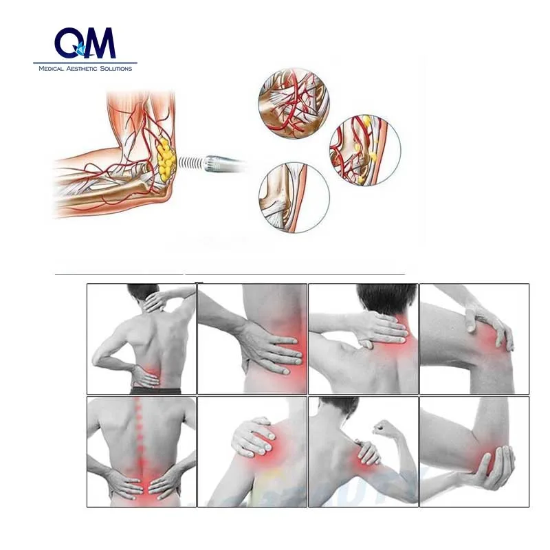 High quality/High cost performance  Eswt Shock Wave Therapy Equipment Eswt for Whole Body Pain Therapy