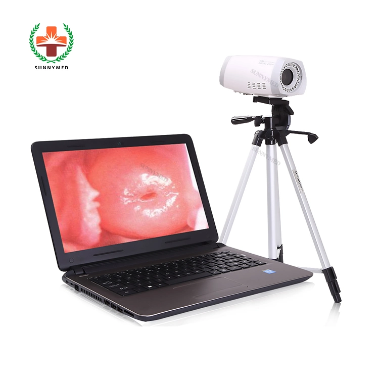 High quality/High cost performance  Hot Sale Women Portable Electronic Colposcope Price