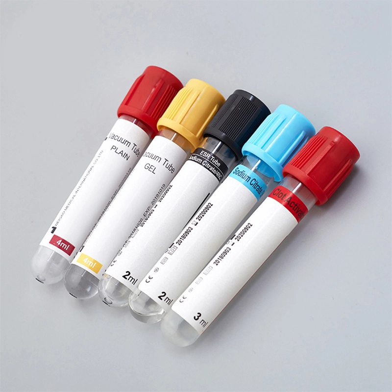 Hospital Vacuum Pet Glass Serum Blood Collecting Tube