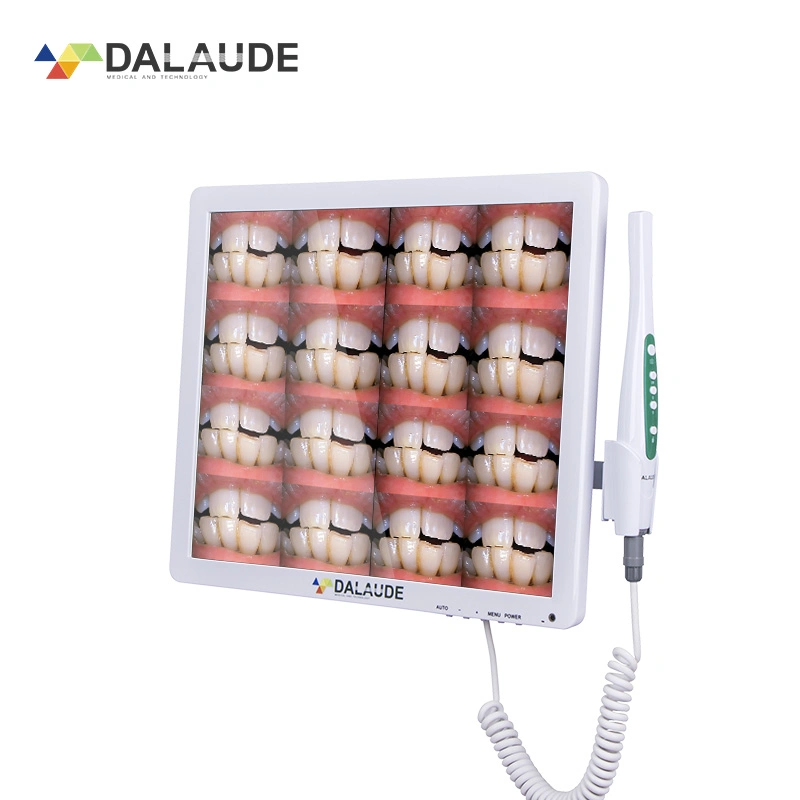 Limpar o comércio intracomunitário Monitor LCD da câmara Oral Equipamentos de terapia oral porta HDMI