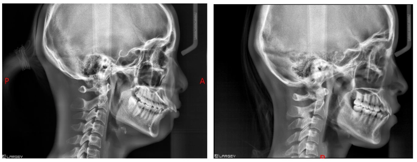 Smart 3D 2D digital Hospital Clinic Cbct Cefalométricas Panorâmica Imagem de raios-X dentário equipamento tomográfico para cirurgia oral com certificado CE