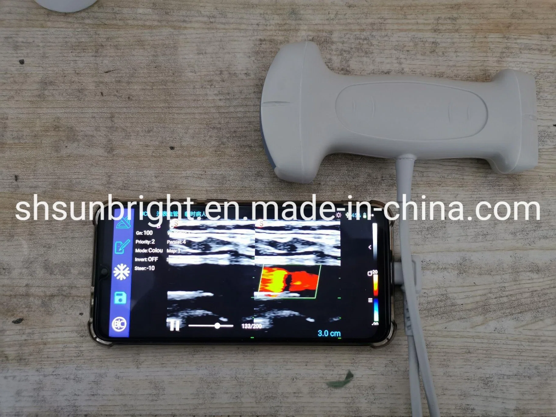 Sun-D3 Deux têtes d'échographie USB Couleur de la sonde linéaire/Sonde convexe