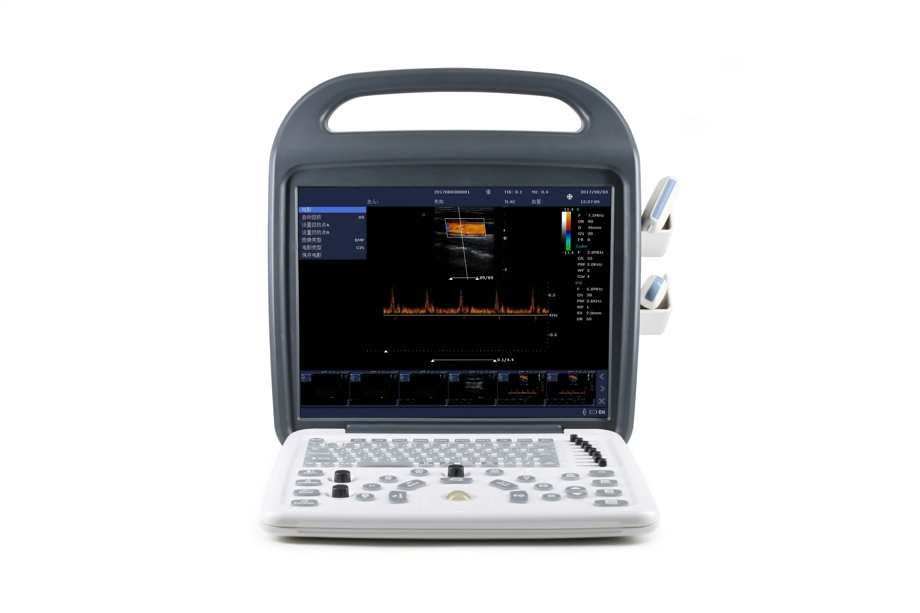 Dcu10 Color Doppler Ultrasound Scanner with Internal Battery