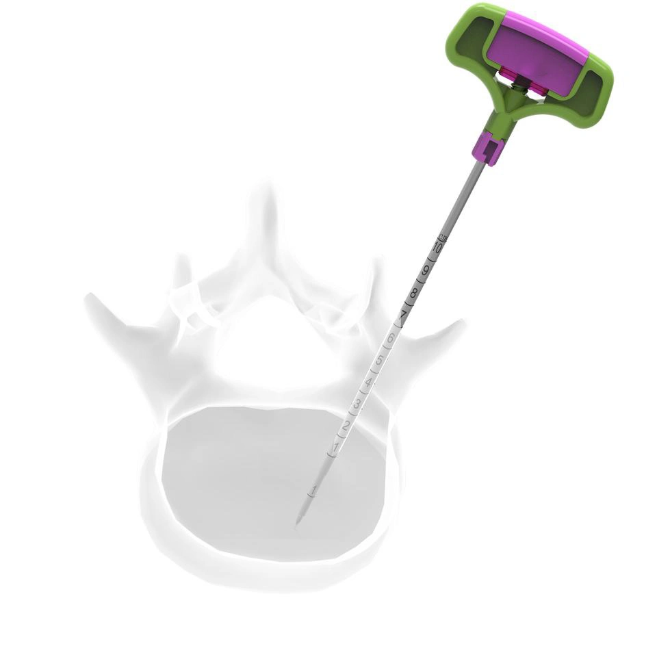 Cifoplastia Juego de herramientas de Vertebroplastia instrumentos espinales PVP hueso Relleno de cemento