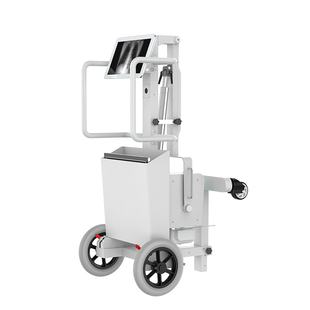 Ltx35 5kw 100mA Trolley Digital Medical Mobile X-ray Equipments with Dr System