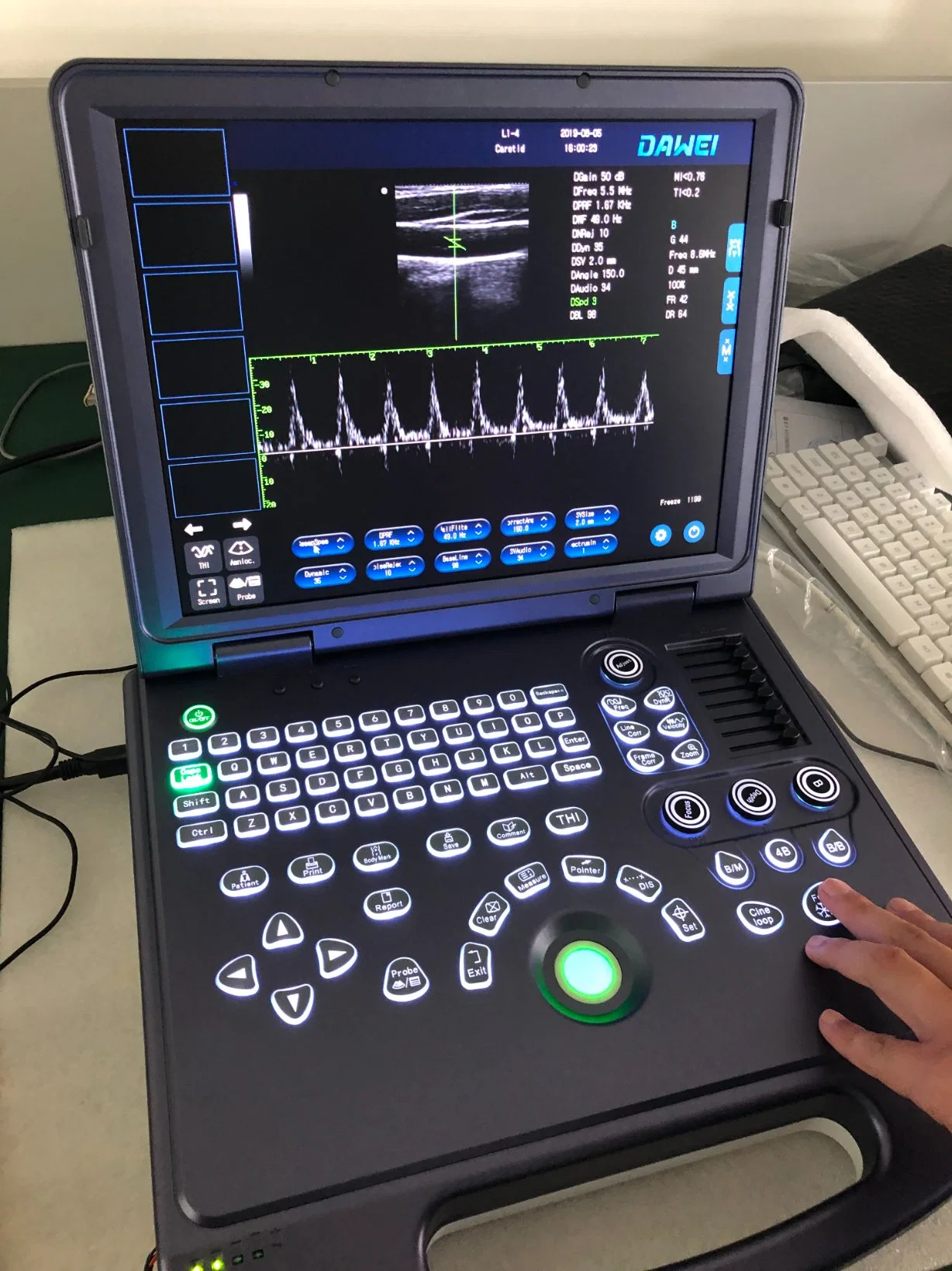 Pw HD Live El Sistema de Diagnóstico por Ultrasonidos