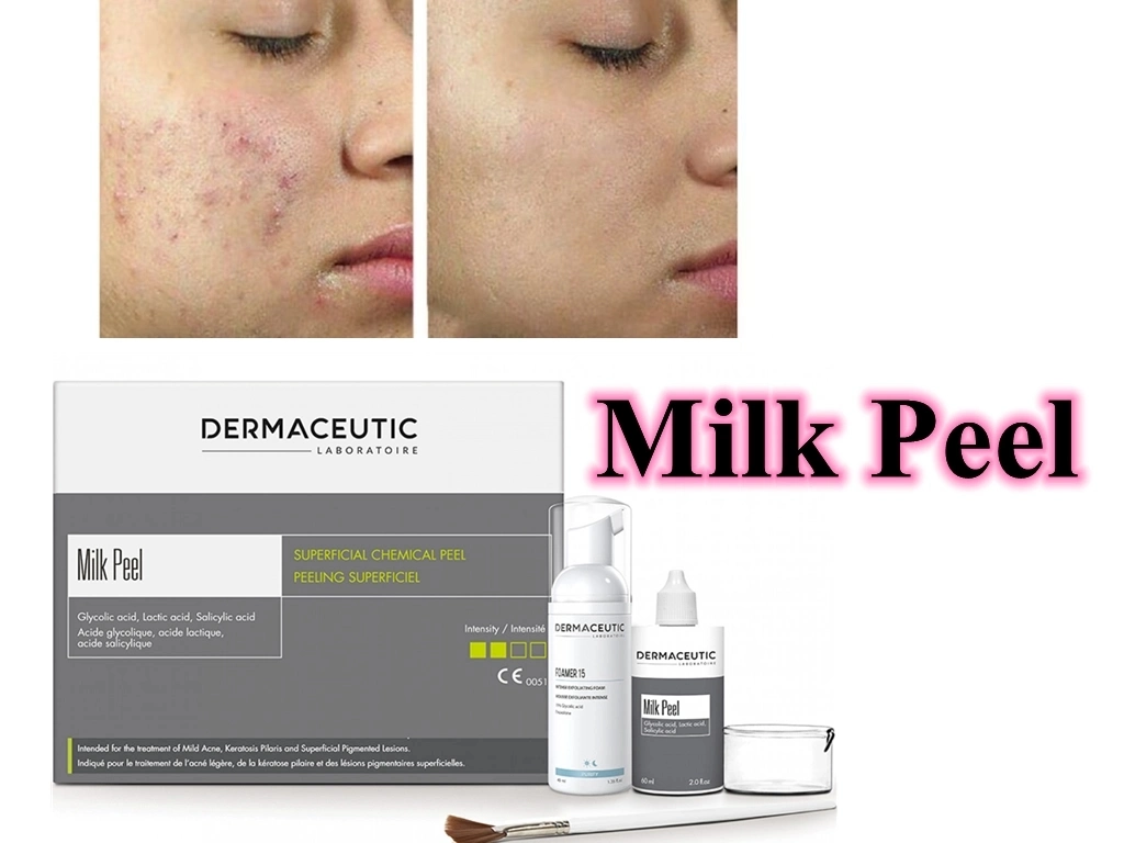 60ml de lait Dermaceutic Peel de traitement du lait de l'Acné exfoliant Peel 60ml réduit les lésions cutanées Acne-Prone corps Cindella Luthione alléger l'Acné Glutax blanchissant la peau