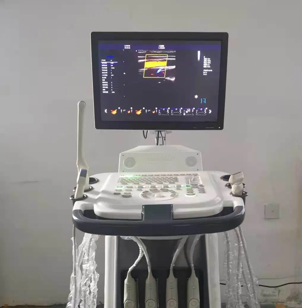 USG meilleure vente chariot ultrasons médical produit à ultrasons