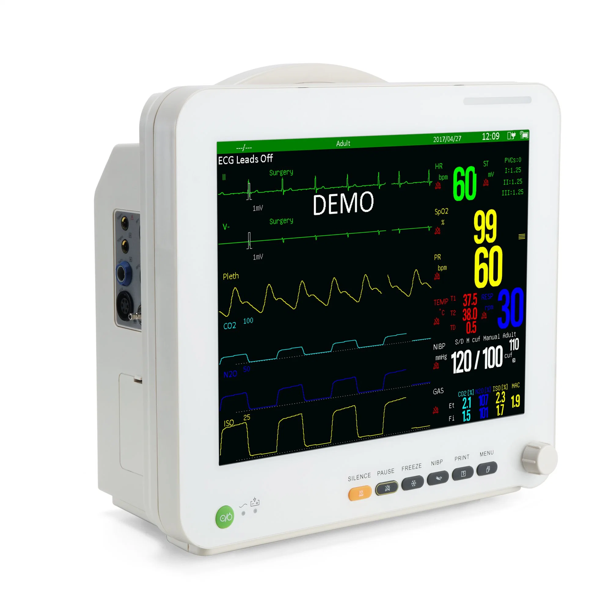 Sinnor 15inch Standard 6parameter Patient Monitor with Full Accessories for Adult Peadiatrict Neonatal and Veterinary Use Snp9000ia Factory Supply